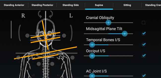 Why Take Postural Measurements?